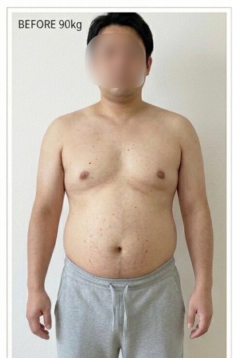 メタボリックシンドローム解消に向けたダイエット開始前の男性の正面姿。上半身は着衣がなく、内臓脂肪による大きなお腹の膨らみや丸みのある体型がはっきりとわかる状態。画面左上に「BEFORE 90kg」と記載