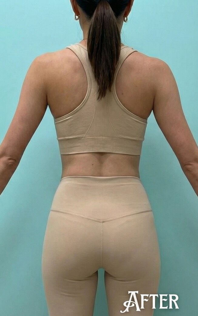 水色の背景の前に立つ、髪をポニーテールにまとめた30代女性の後ろ姿。ベージュのブラトップとレギンスを着用。背中からウエストにかけての素肌が見えており、肩甲骨周りや背中がすっきりとしている。腰回りのお肉のたるみがなくなり、ウエストラインが美しく引き締まったダイエット後の状態。身体のAfter。